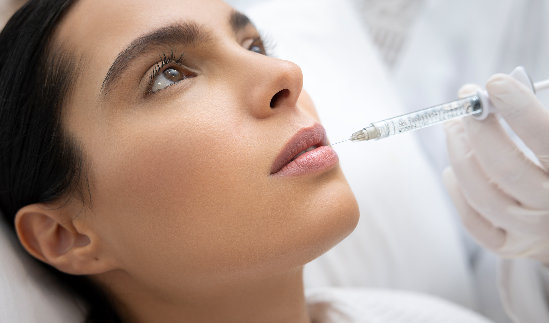 Lip Fillers