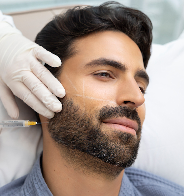 Radiesse Filler
