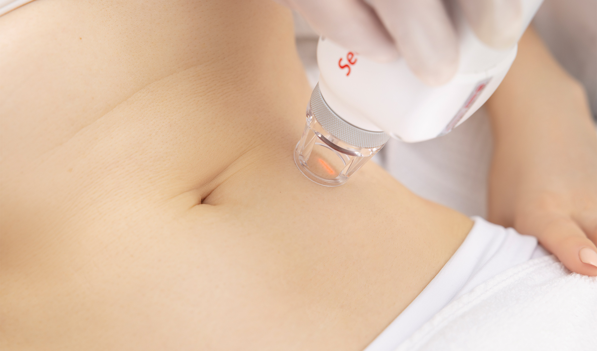 Secret Erbium – Glass Fractional Laser