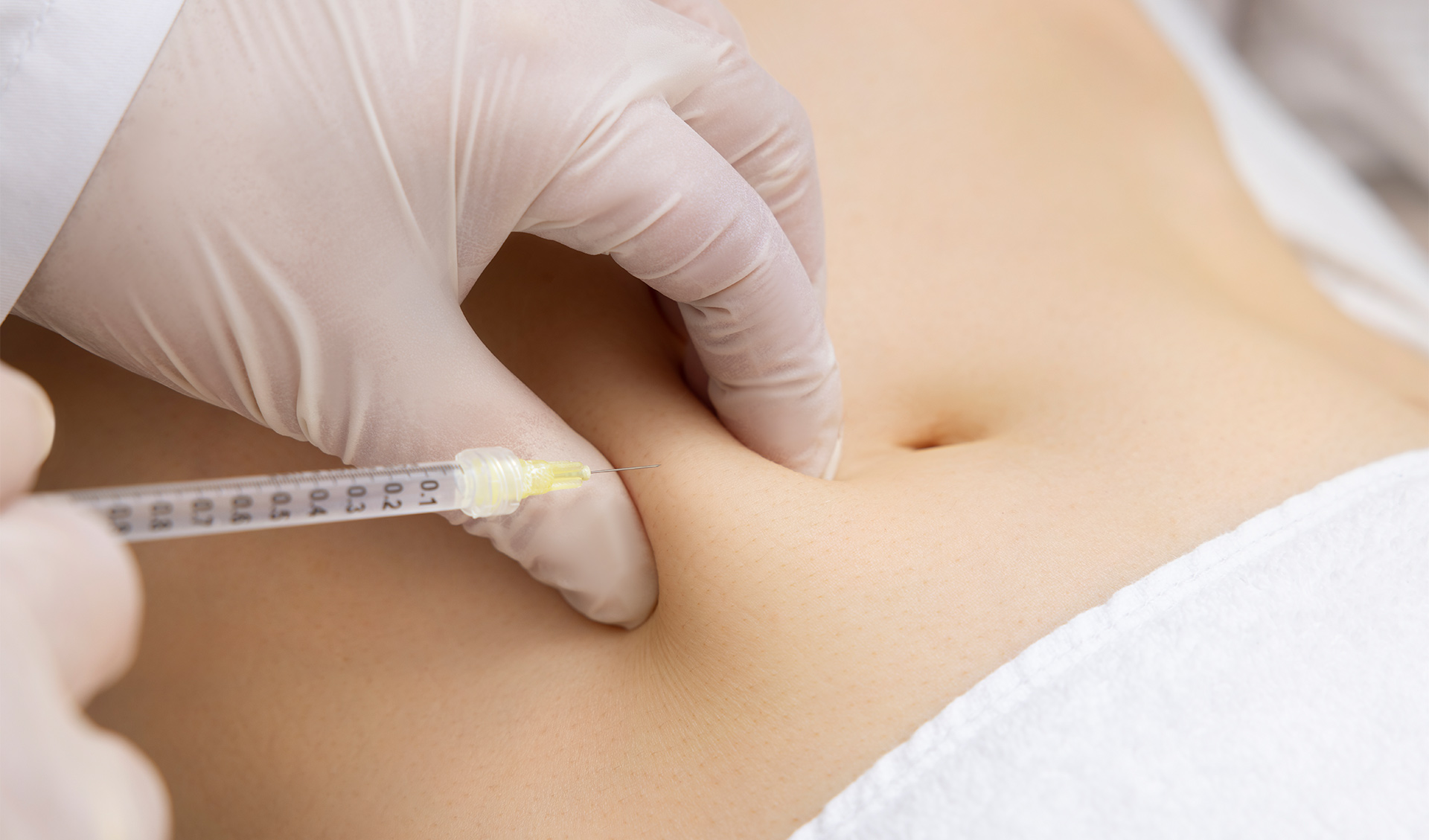Lipolysis