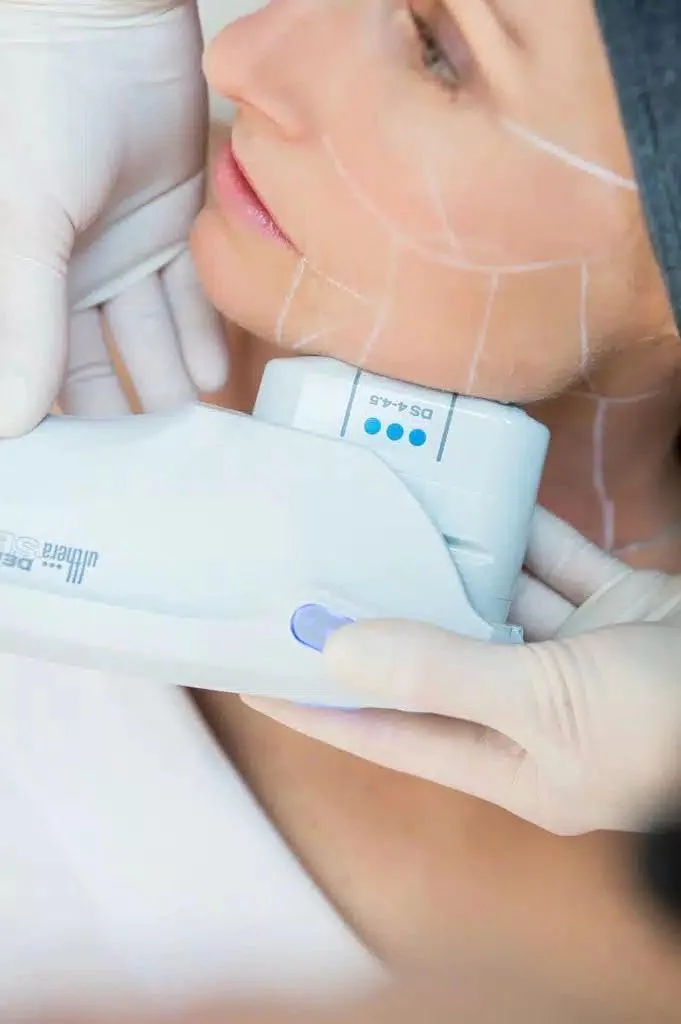 ultherapy dubai